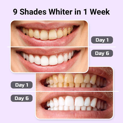 Puur Smile Teeth Whitening Kit - LED Light, Gel, Remineralization for Sensitive Teeth