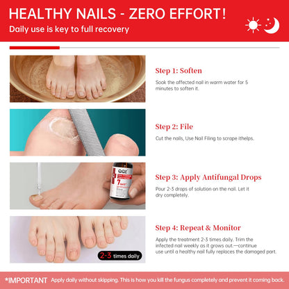 QQE Nail Fungus Treatment Extra Strength - 25% Undecylenic Acid