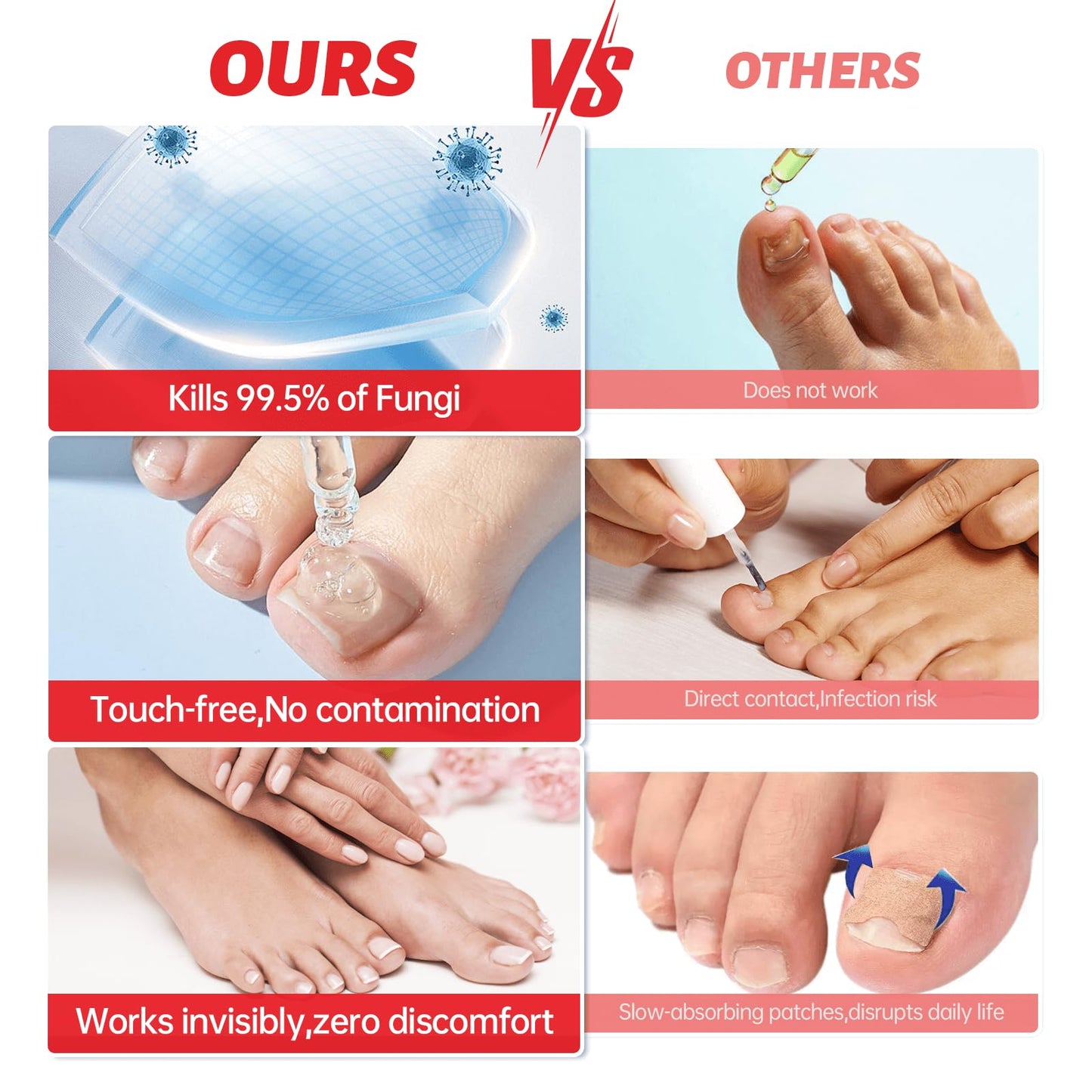 QQE Nail Fungus Treatment Extra Strength - 25% Undecylenic Acid