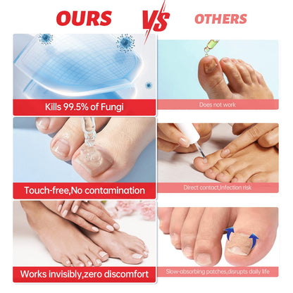 QQE Nail Fungus Treatment Extra Strength - 25% Undecylenic Acid