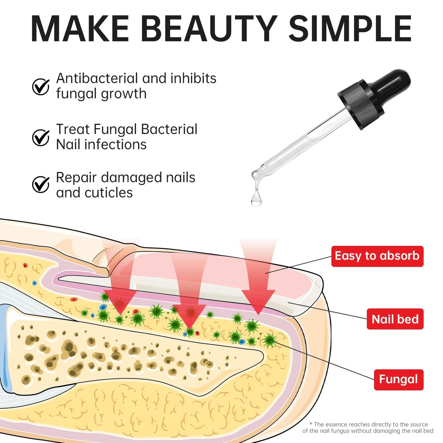 QQE Nail Fungus Treatment Extra Strength - 25% Undecylenic Acid