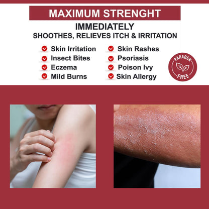 QUATRIDERM NF Extra Strength Hydrocortisone 1% Cream with Aloe Vera – Paraben-Free, 2 oz