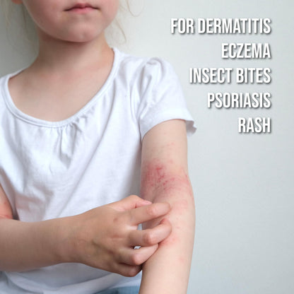 quitch Hydrocortisone Healing Balm – Kid-Friendly Eczema & Psoriasis Relief Stick