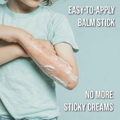 quitch Hydrocortisone Healing Balm – Kid-Friendly Eczema & Psoriasis Relief Stick