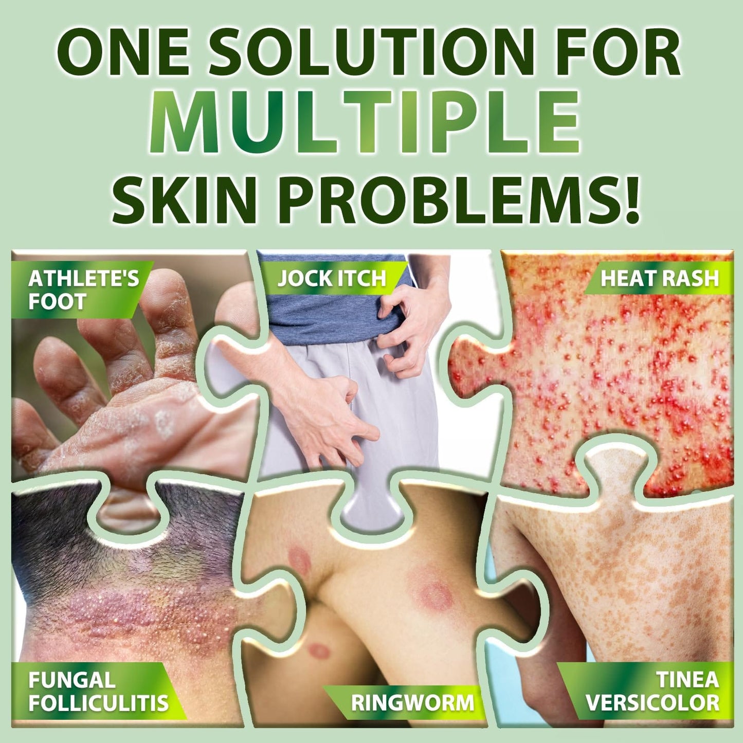 Recuren Plus Antifungal Cream with Tea Tree Oil – Herbal Skin Relief for Fungus, Jock Itch & Athlete's Foot (100g)
