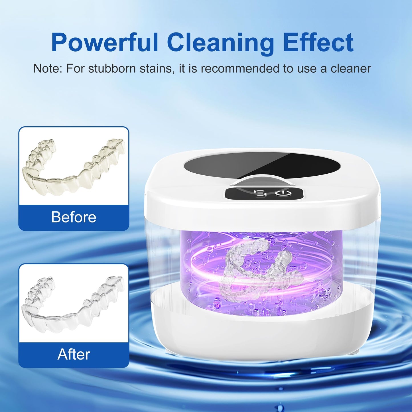 Professional Ultrasonic Retainer Cleaner 45kHz – Portable 190ml, Clean Retainers, Aligners, Dentures