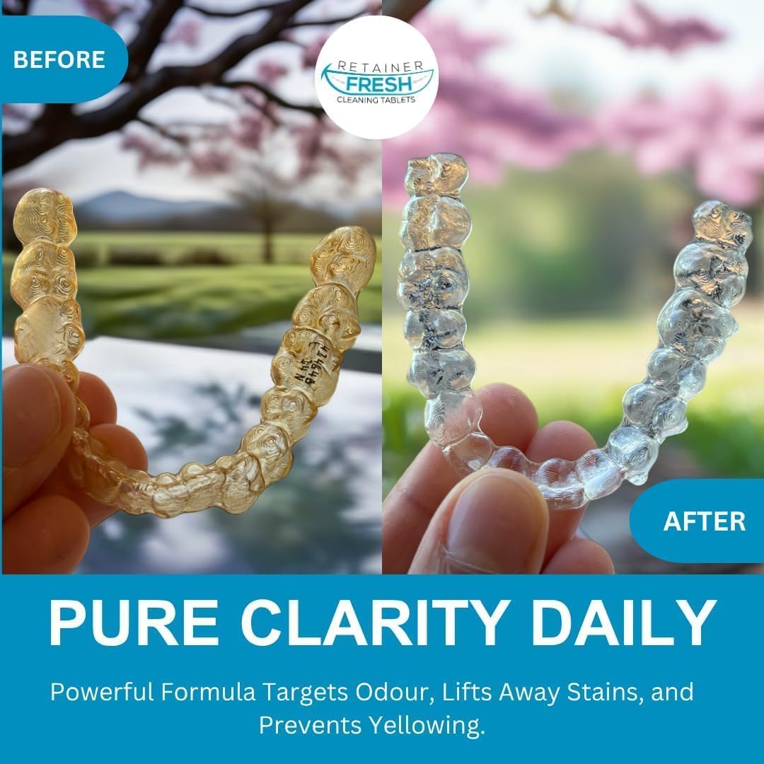 Retainer Cleaner Tablets – 36 Count | Aligners, Dentures & Mouth Guards