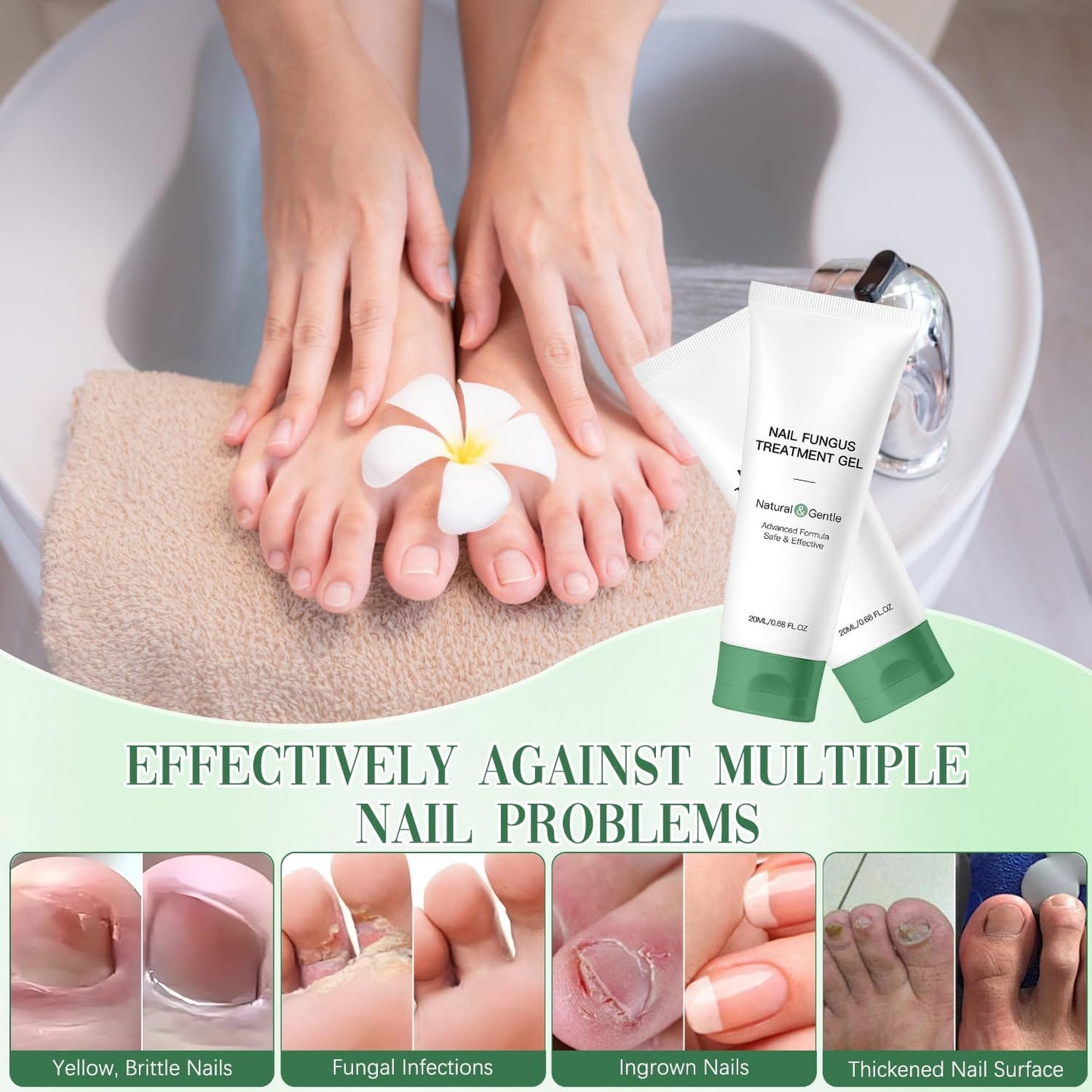Retigazo 2PCS Nail Repair Gel – Multi-Purpose Nail Care & Growth Serum