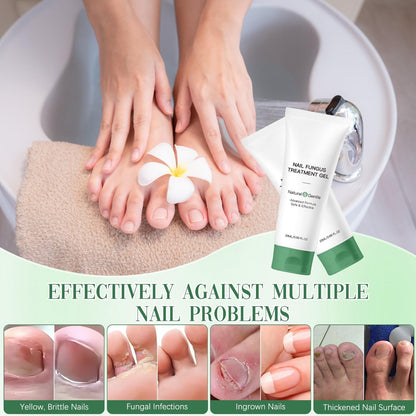 Retigazo 2PCS Nail Repair Gel – Multi-Purpose Nail Care & Growth Serum
