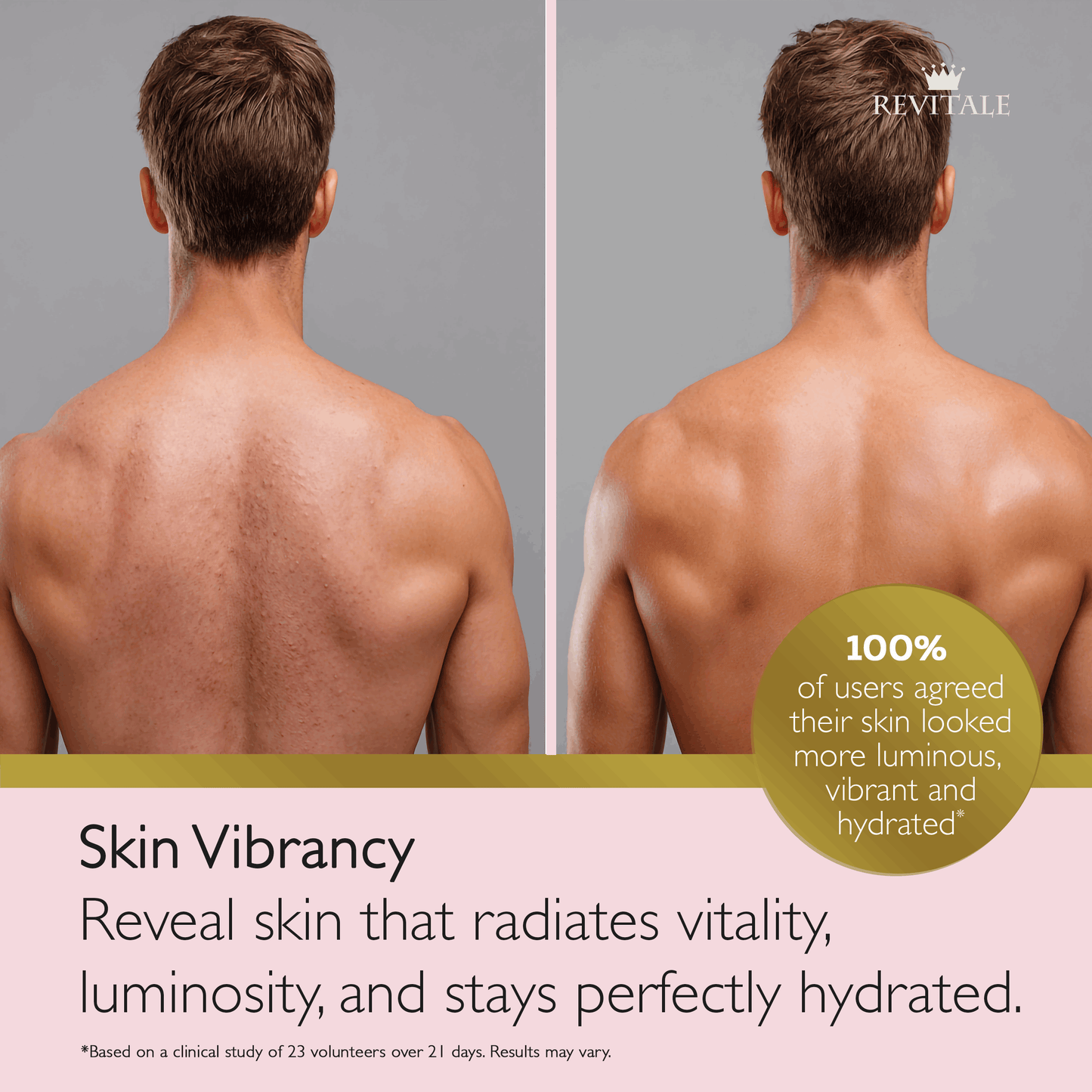 Revitale Advanced Salicylic Acid Cream 80g