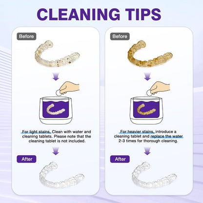 Rolipo Ultrasonic Retainer Cleaner 320ML – 45kHz Denture Cleaner with 4 UV Lamps