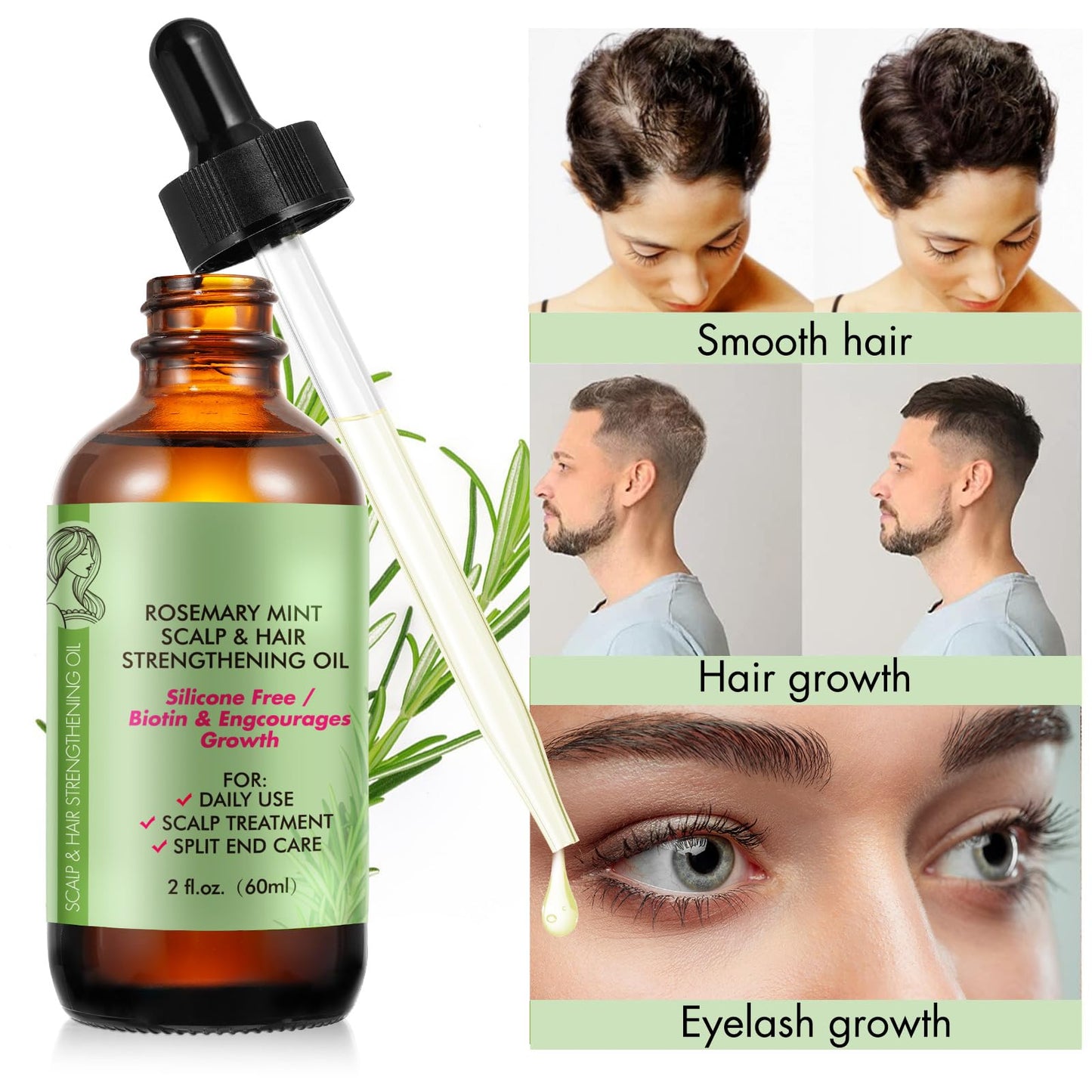 Rosemary Oil for Hair Growth - Pure Rosemary Essential Oil for Scalp Nourishment