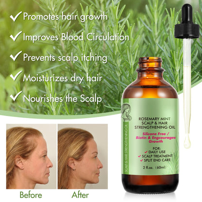 Rosemary Oil for Hair Growth - Pure Rosemary Essential Oil for Scalp Nourishment