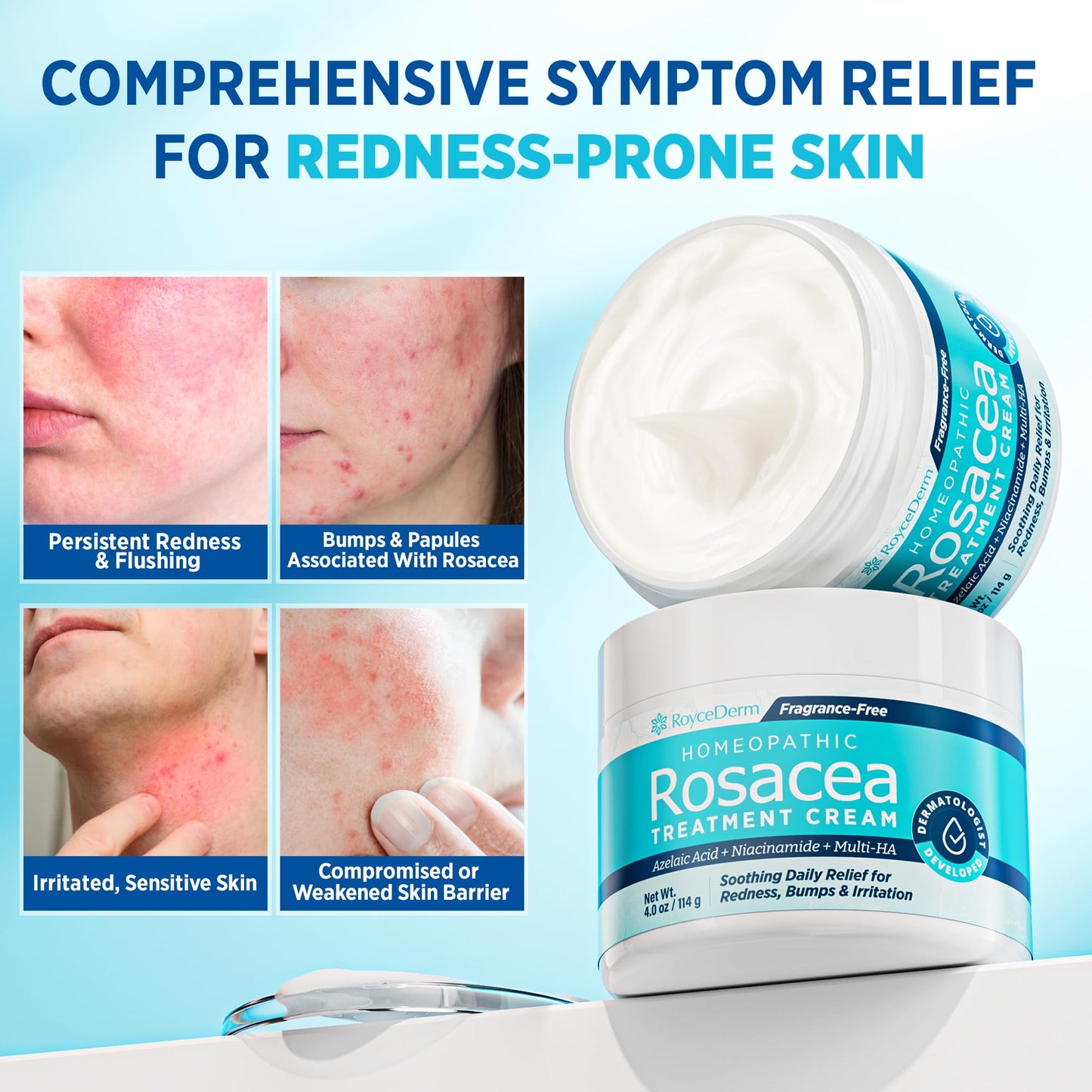 Roycederm Rosacea Treatment with Azelaic Acid – Redness Relief & Corrector for Sensitive Skin