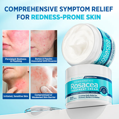 Roycederm Rosacea Treatment with Azelaic Acid – Redness Relief & Corrector for Sensitive Skin