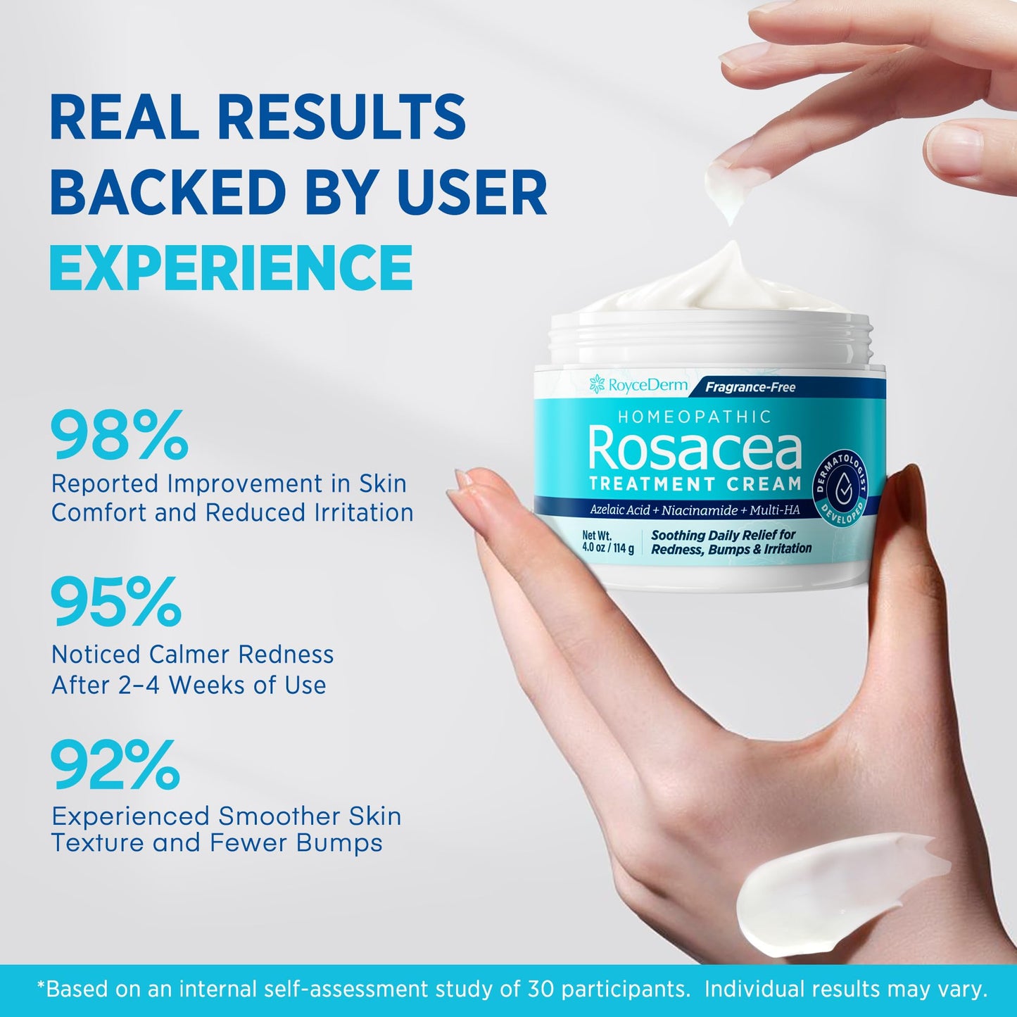 Roycederm Rosacea Treatment with Azelaic Acid – Redness Relief & Corrector for Sensitive Skin