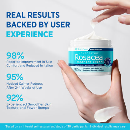 Roycederm Rosacea Treatment with Azelaic Acid – Redness Relief & Corrector for Sensitive Skin