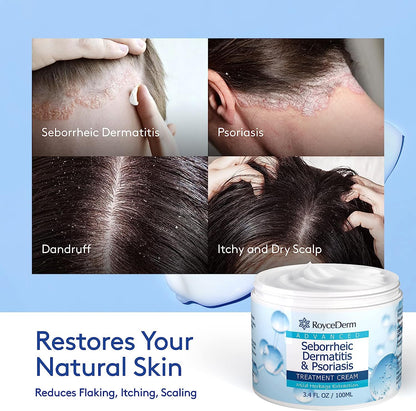 Roycederm Seborrheic Dermatitis Cream – Scalp Treatment for Psoriasis, Dandruff & Dry Scalp