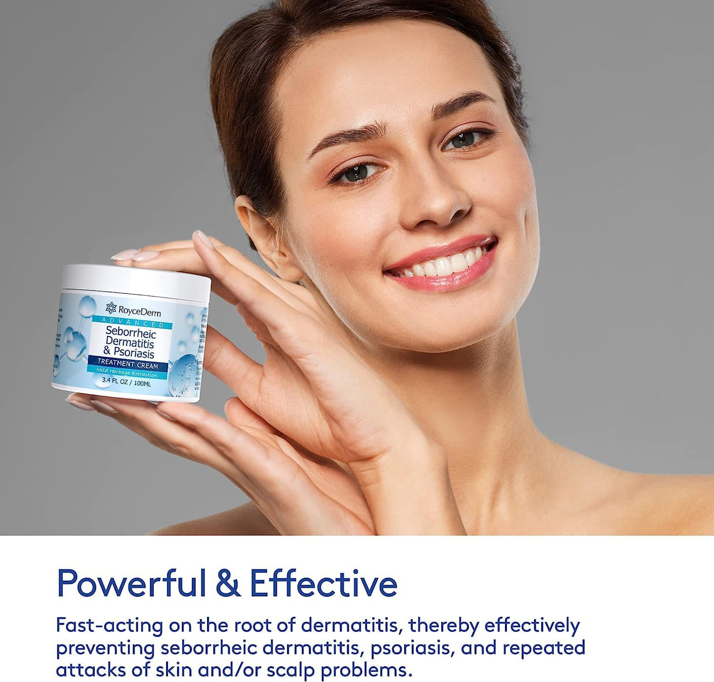 Roycederm Seborrheic Dermatitis Cream – Scalp Treatment for Psoriasis, Dandruff & Dry Scalp