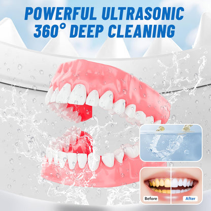 Ruolar Ultrasonic Retainer Cleaner – 45kHz Dental Cleaning Pod for Dentures & Jewelry