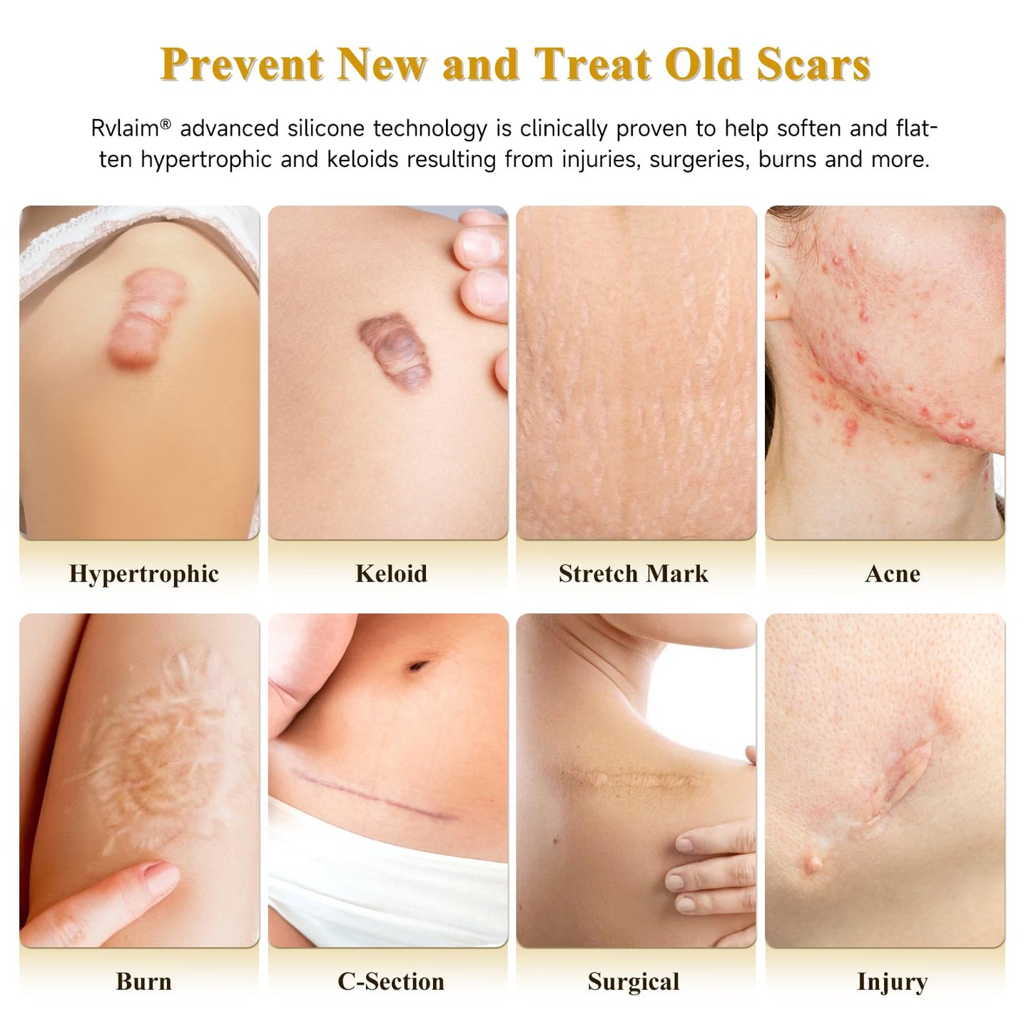 Rvlaim Silicone Scar Cream Gel – Advanced Scar Care for Surgical Scars & More (1.85 oz)