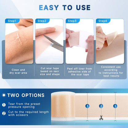 Rvlaim Silicone Scar Sheets Tape Roll 1.6” x 60” – Breathable, Reusable Scar Care for Surgical Scars, Keloids, Stretch Marks