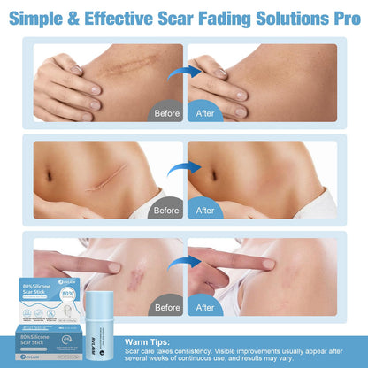Rvlaim Silicone Scar Stick — 80% Silicone for Face & Body (7g)