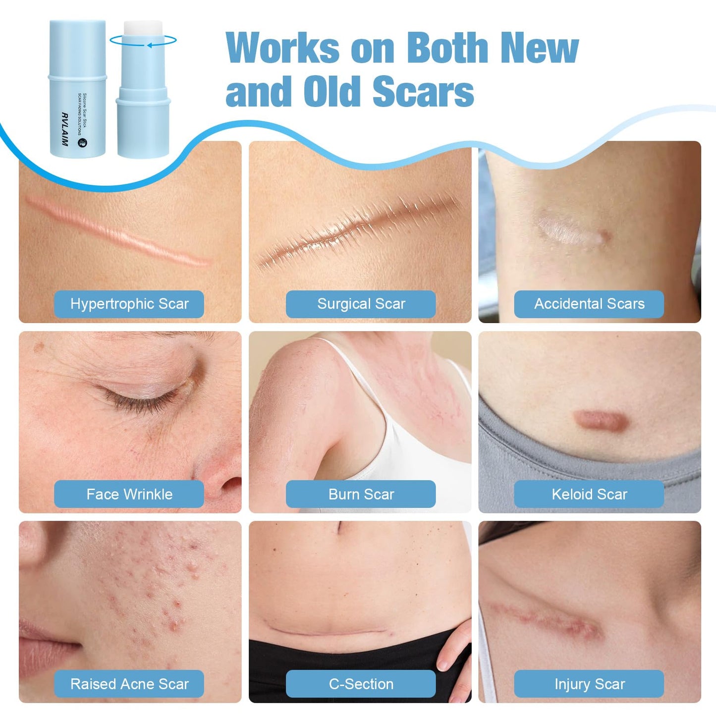 Rvlaim Silicone Scar Stick — 80% Silicone for Face & Body (7g)