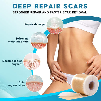 Rvlaim Silicone Scar Sheets & Tape (1.6”x60” Roll) – Gentle, Flexible Scar Care