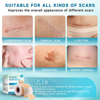 Rvlaim Silicone Scar Sheets & Tape (1.6”x60” Roll) – Gentle, Flexible Scar Care