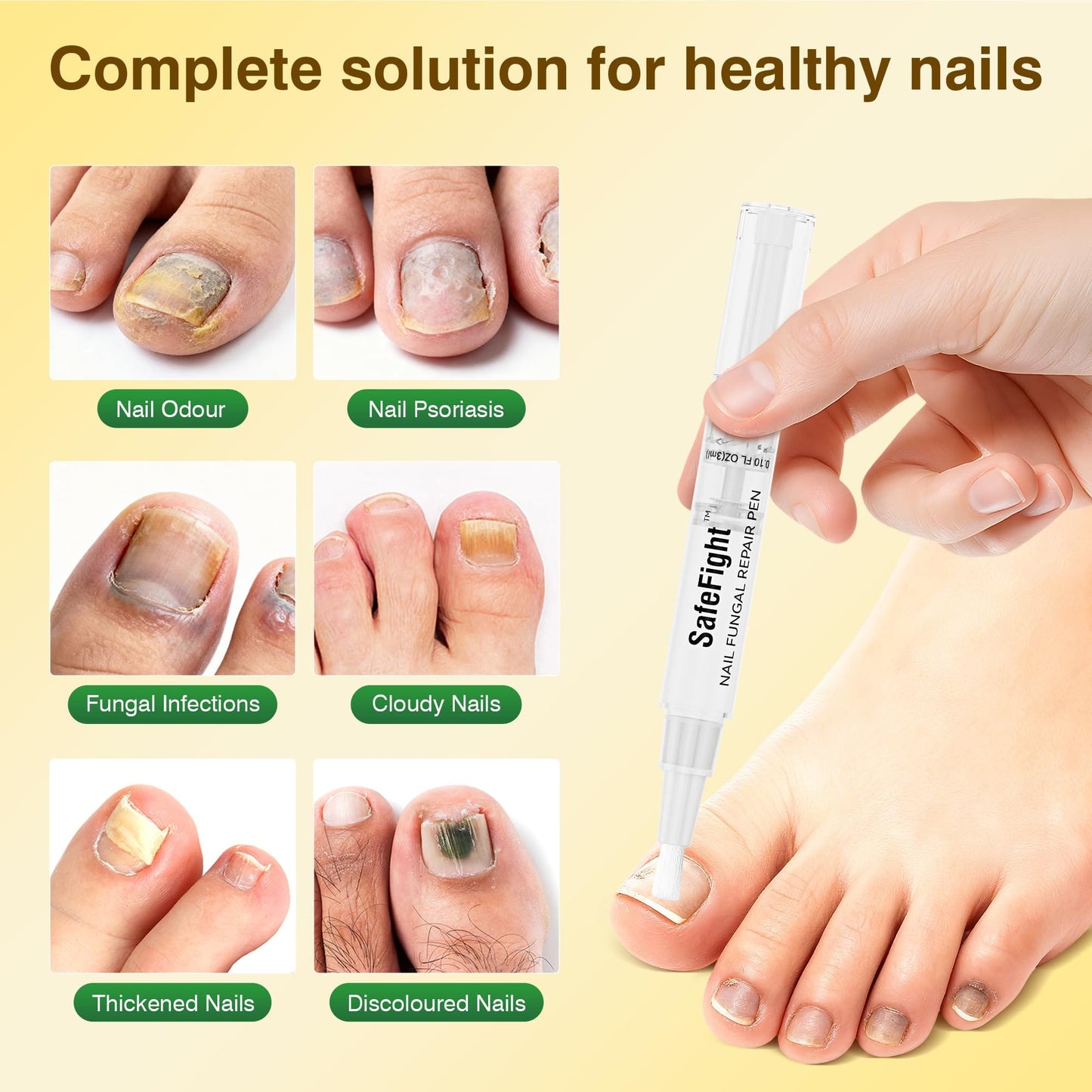SafeFight Toenail Fungi Treatment Extra Strength Pen – 3-Pack with 25% Undecylenic Acid
