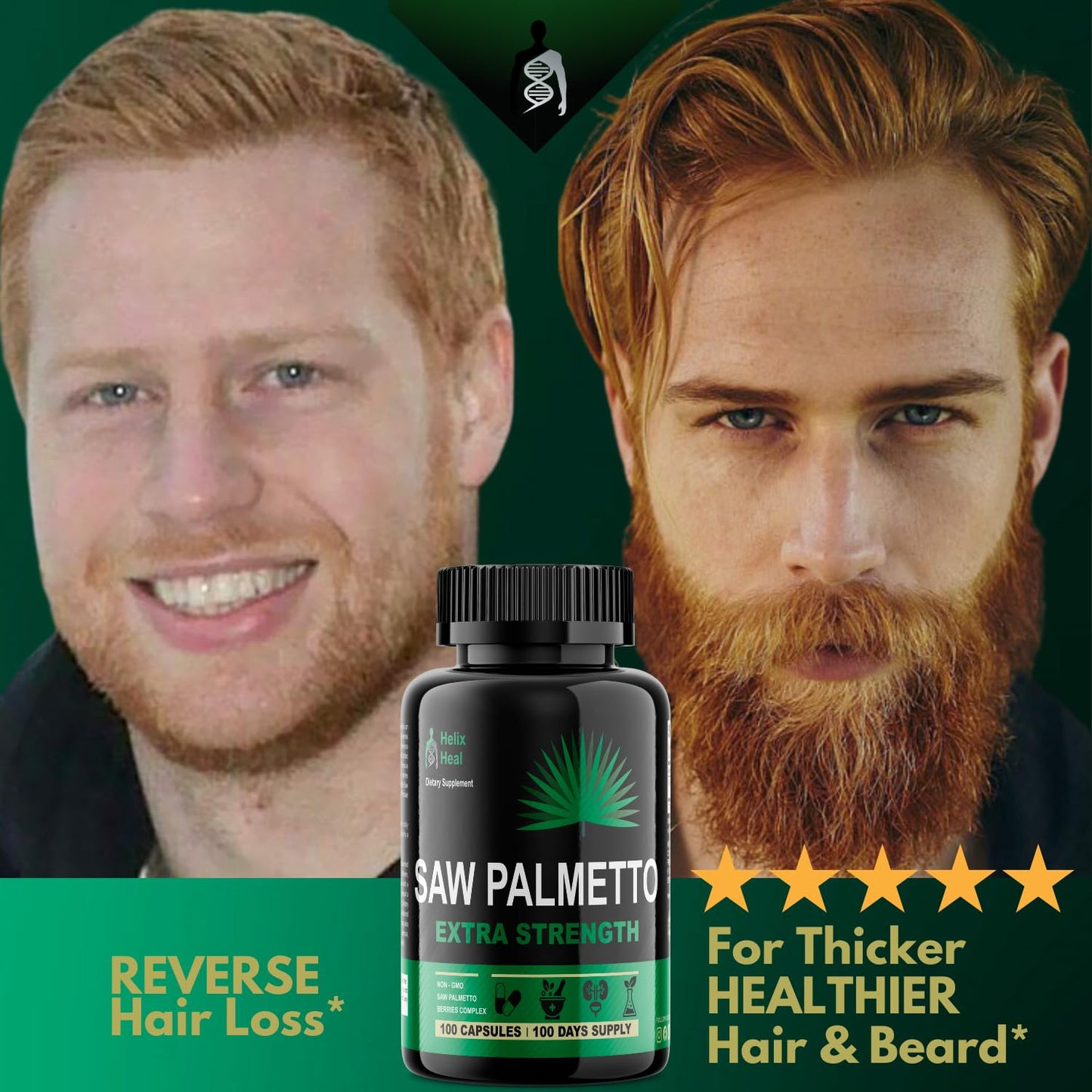 Saw Palmetto for Men - 500mg Prostate Health & Hair Growth (100 capsules)