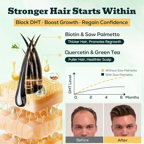 Saw Palmetto Gummies for Men – 600mg DHT Blocker with Biotin & Pumpkin Seed, 60 Gummies