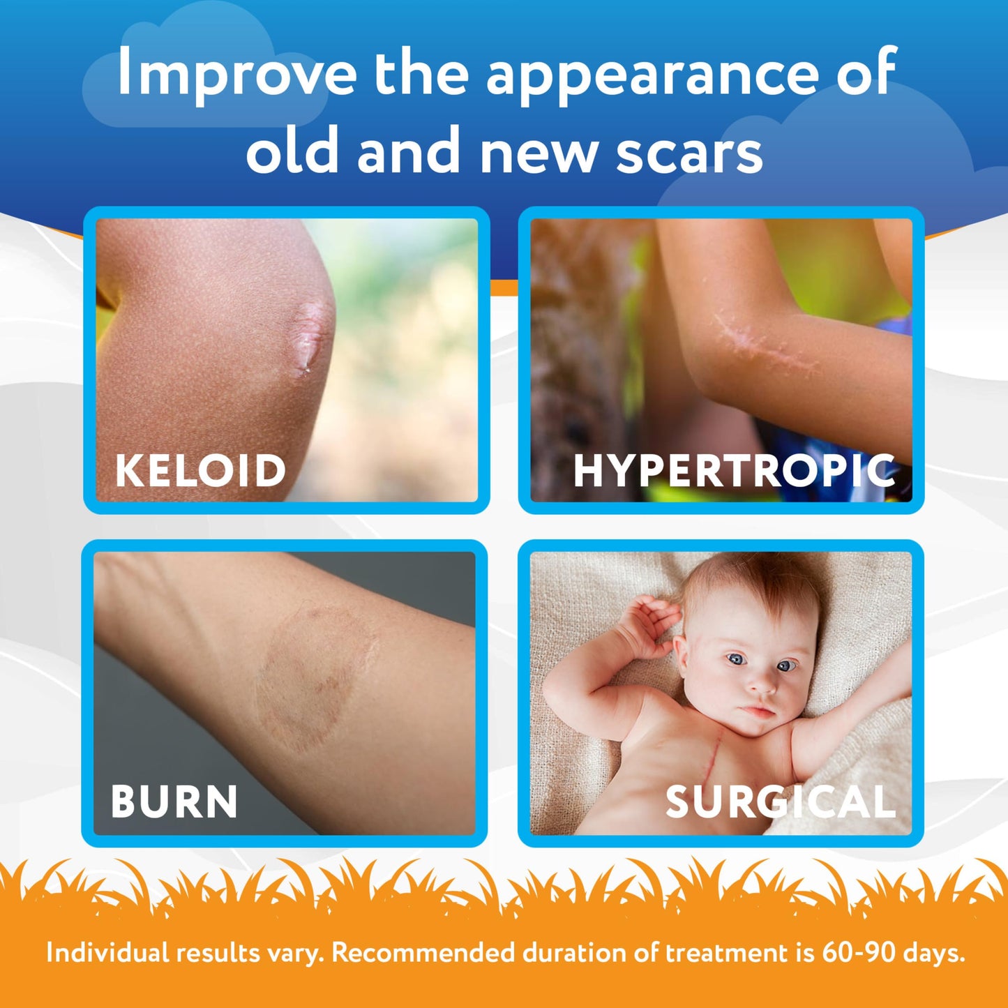 ScarAway Kids Silicone Scar Gel – Medical-Grade, 6g, Improves Scar Color & Texture