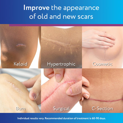 ScarAway Silicone Scar Gel – Improve Size, Color & Texture of Hypertrophic & Keloid Scars (10g)