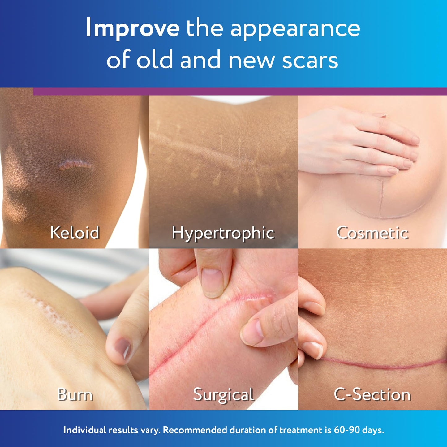 ScarAway Silicone Scar Gel - Improve Scar Size, Color & Texture | Water-Resistant 20g