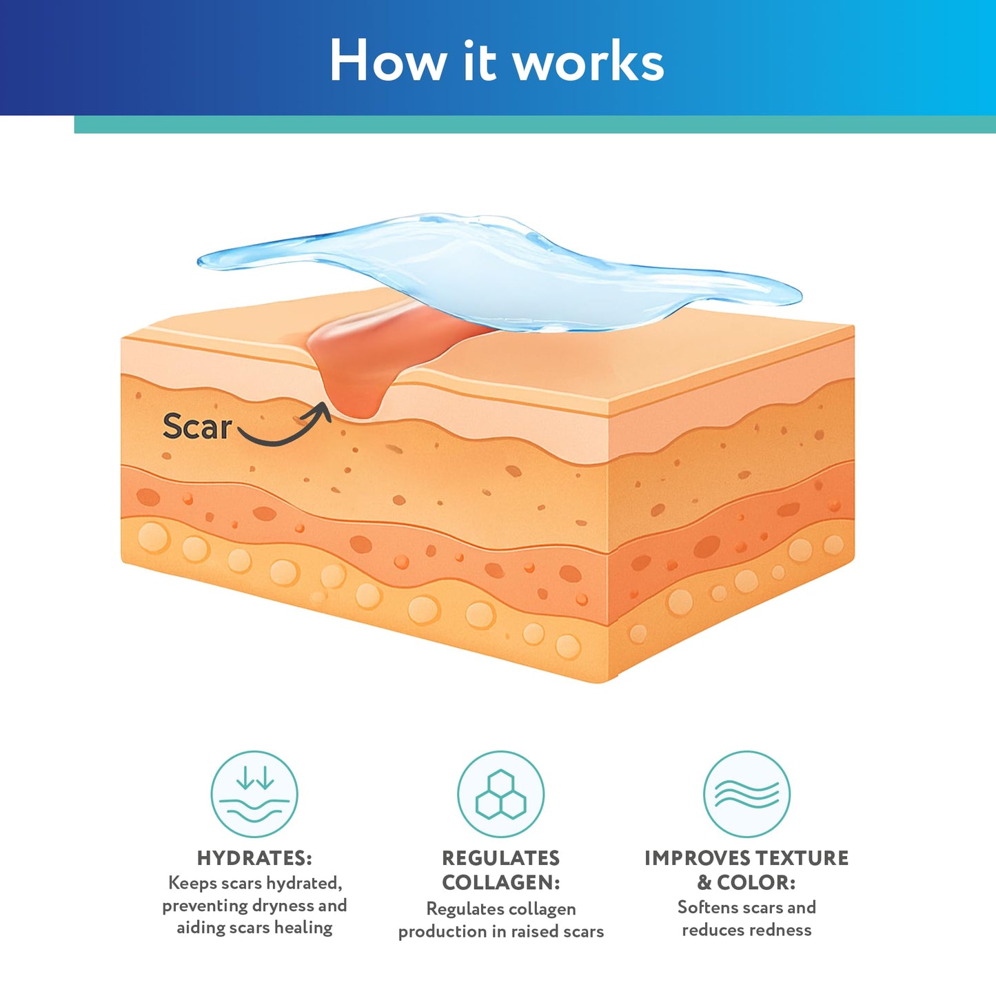 ScarAway Silicone Scar Gel – Improve Size, Color & Texture of Hypertrophic & Keloid Scars (10g)