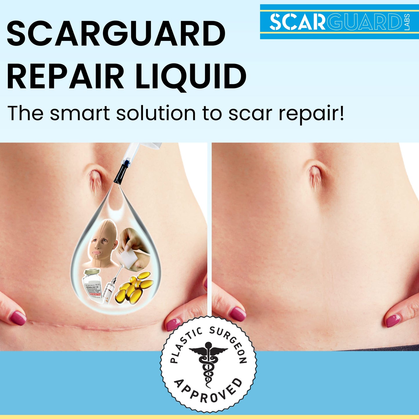 ScarGuard - Invisible Brush-On Silicone Liquid with Vitamin E for Scars (Keloids, Surgical, Burns)