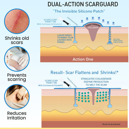 ScarGuard - Invisible Brush-On Silicone Liquid with Vitamin E for Scars (Keloids, Surgical, Burns)