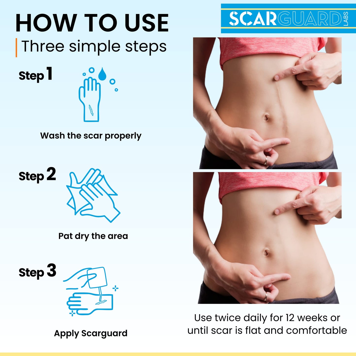 ScarGuard - Invisible Brush-On Silicone Liquid with Vitamin E for Scars (Keloids, Surgical, Burns)
