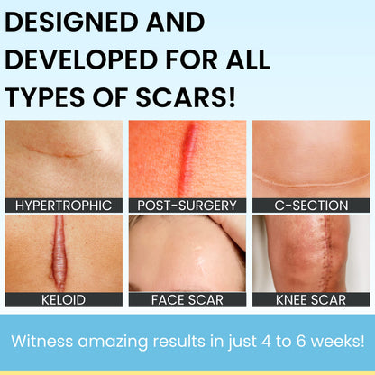 ScarGuard - Invisible Brush-On Silicone Liquid with Vitamin E for Scars (Keloids, Surgical, Burns)