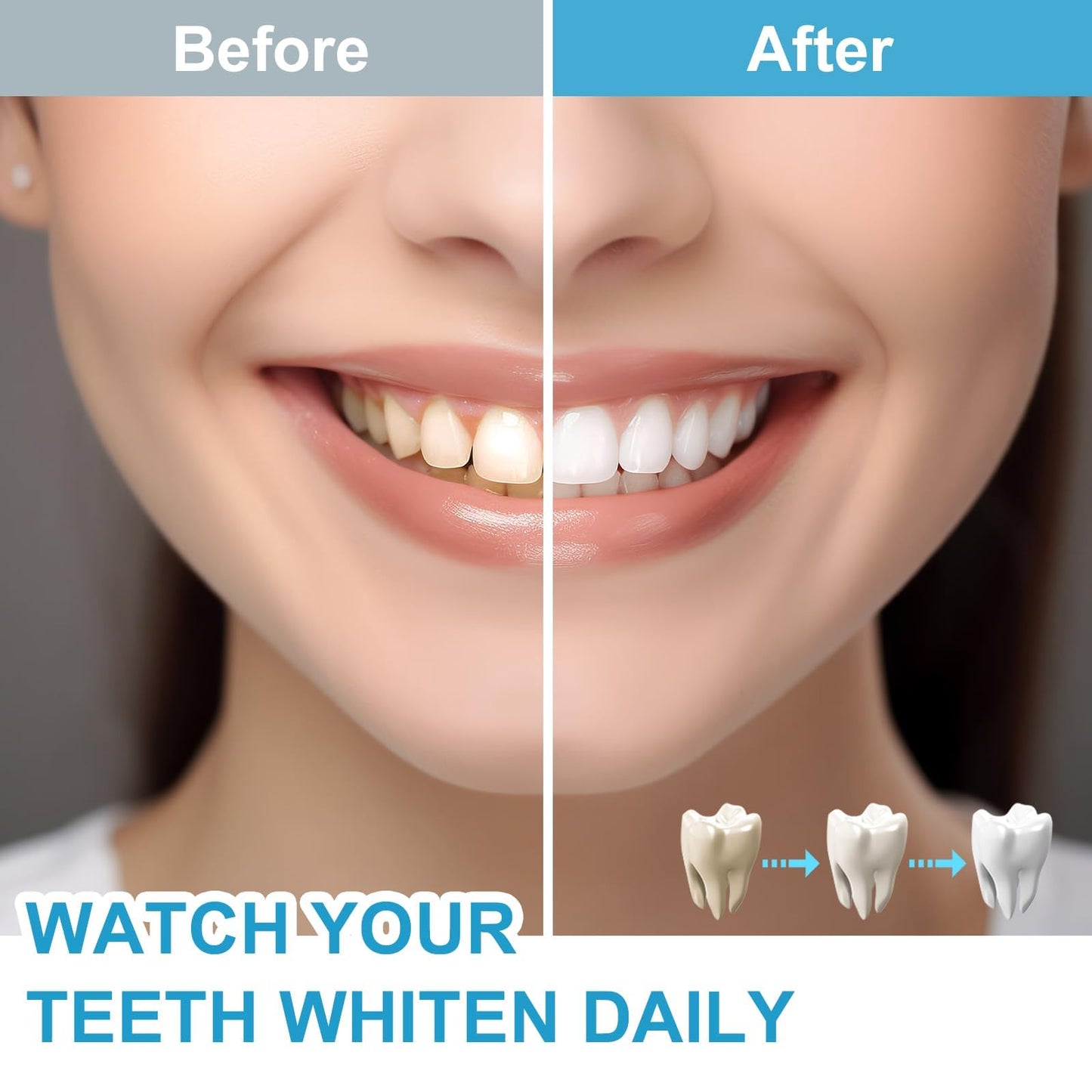 Sensitive Teeth Whitening Kit with LED Light Therapy | Safe At-Home Whitening
