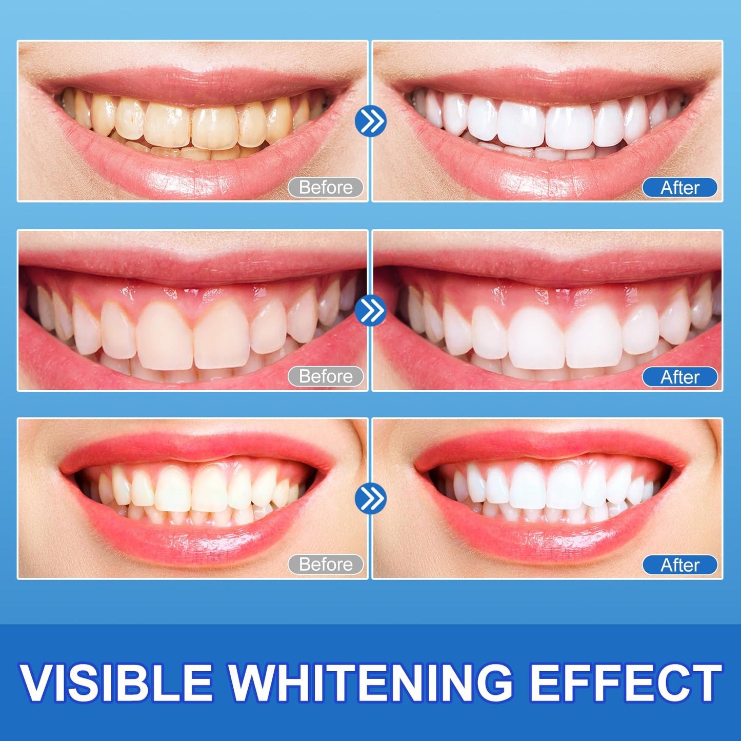 Sensitive Teeth Whitening Strips Kit – 28 Strips, 14 Treatments, Safe for Sensitive Teeth