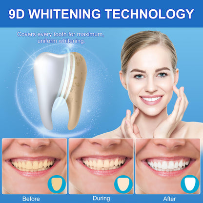 Sensitive Teeth Whitening Strips Kit – 28 Strips, 14 Treatments, Safe for Sensitive Teeth