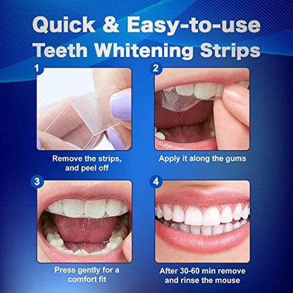Sensitive Teeth Whitening Strips Kit – 28 PCS, 14 Treatments, Hydrogen Peroxide-Free