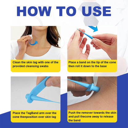 SHISUIZHE Skin Tag Remover – FDA-Cleared At-Home Skin Tag Removal Kit