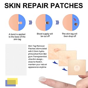 SHISUIZHE Skin Tag Remover – FDA-Cleared At-Home Skin Tag Removal Kit