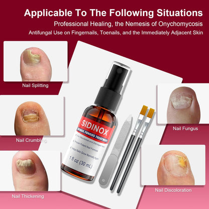 Sidinox Toenail Fungus Treatment Extra Strength with 25% Undecylenic Acid — 5 Pack