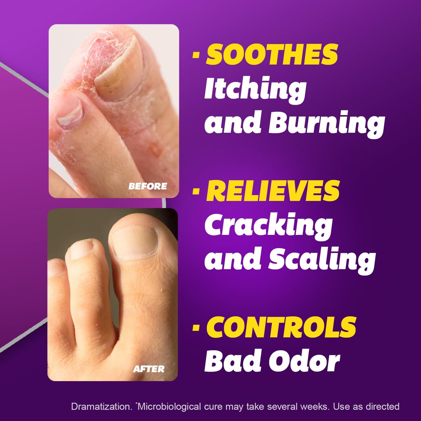 SILKA Anti-Fungal Cream - Maximum Strength 1% Terbinafine for Athlete's Foot, Jock Itch & Ringworm (1 oz)