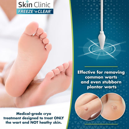 Skin Clinic Freeze 'n Clear Advanced Wart Remover — USA-Made Cryo-Freeze Kit with 12 Precision-Tip Applicators | FDA-Cleared